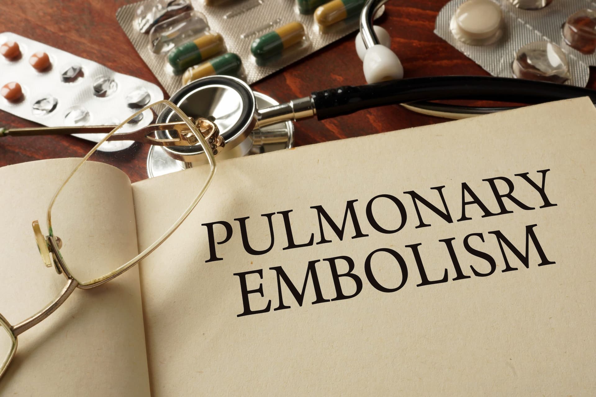 Open medical book displaying the words pulmonary embolism surrounded by medical equipment.